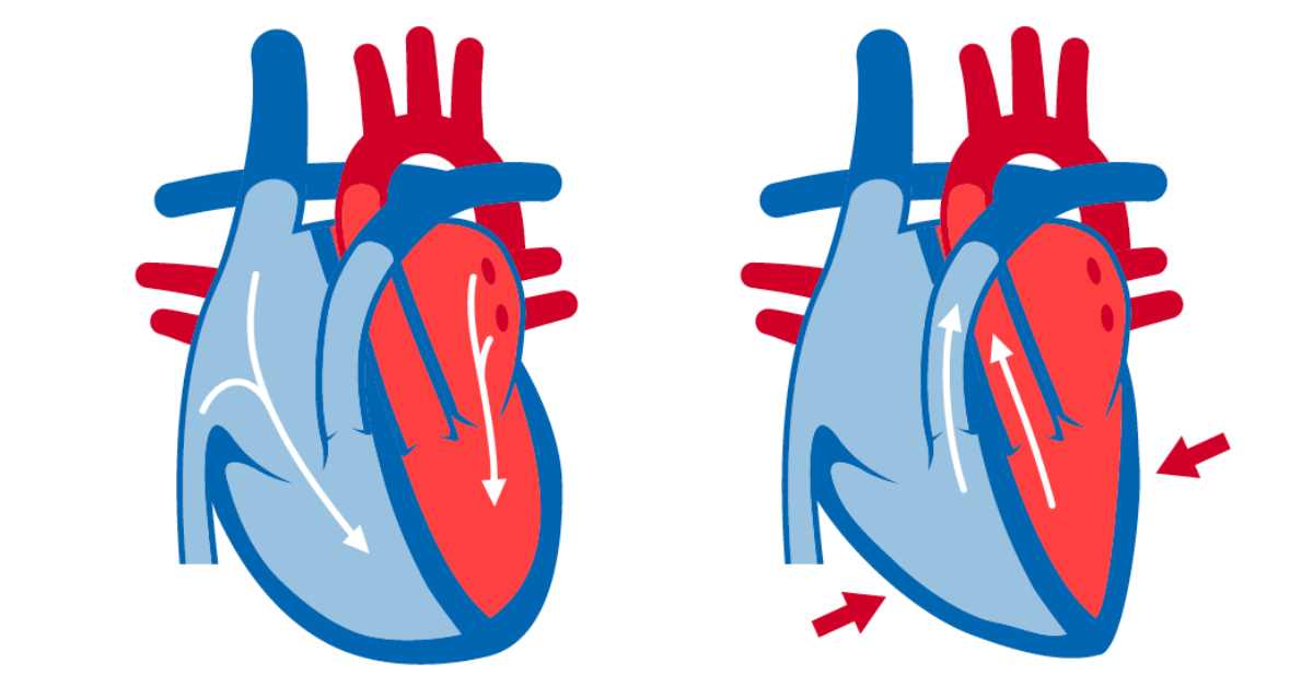 decoding-blood-pressure-understanding-classifications-types-and